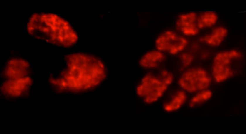 Developing sensory organ cells expressing normal (left) or activated Cdk1 (right).