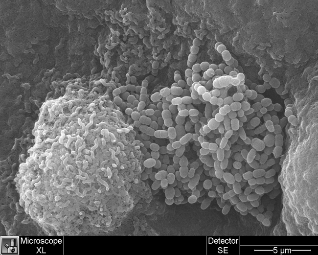 3D image of campylobacter jejuni and unidentified microbes, taken with a scanning electron microscope