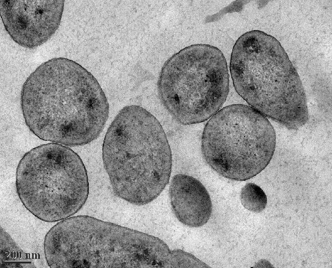 a cross section of bacteria cells, taken with a transmission electron microscope