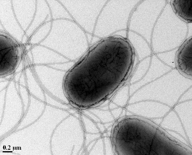 a negative stain of bacteria cells with flagella, taken with a transmission electron microscope