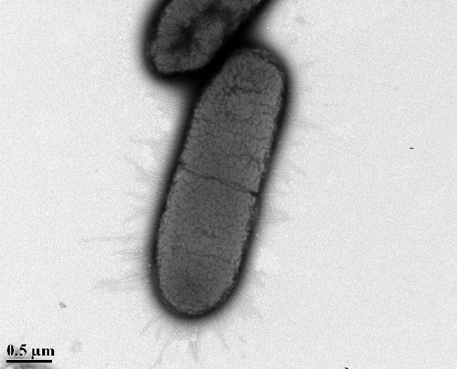 a negative stain of bacteria cells with pili, taken with a transmission electron microscope