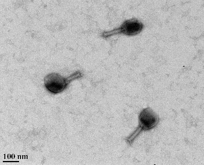 Three bacterophages, taken with a transmission electron microscope