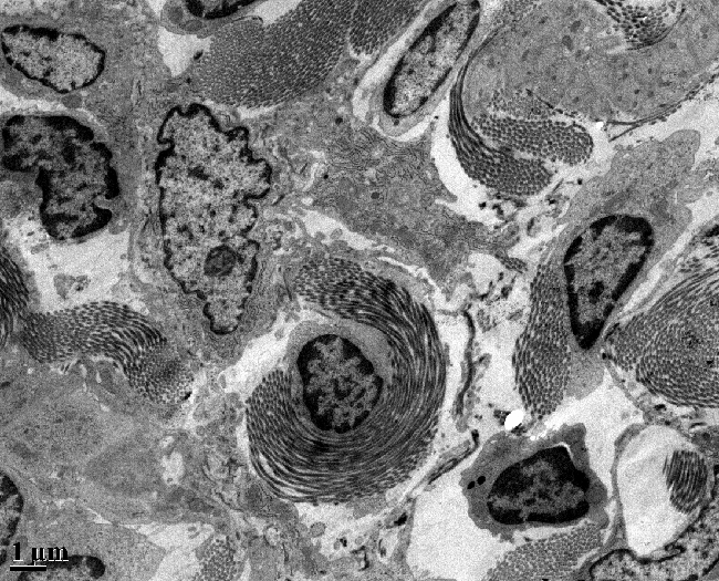 connective tissue in a mouse kidney, taken with a transmission electron microscope