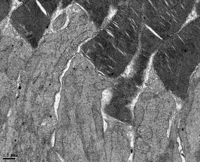 photoreceptor cells of a mouse retina, taken with a transmission electron microscope