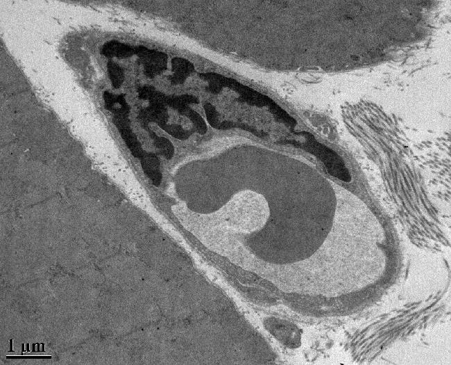 a muscle capillary with endolithia and red blood cells, taken with a transmission electron microscope