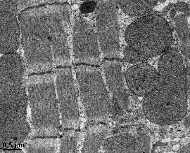 microscopic image of muscle fibers and mitochondria, taken with a transmission electron microscope