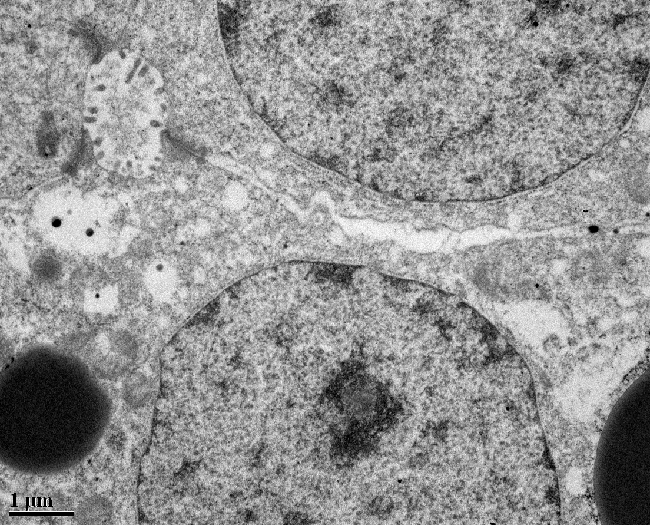 microscopic image of a pacific hagfish's liver cells, taken with a transmission electron microscope