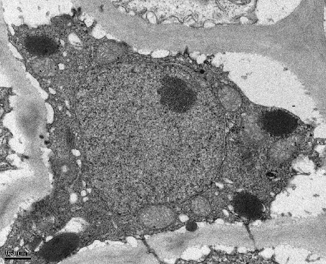 microscopic image of a plant cell with visible organelles and a thick cell wall, taken with a transmission electron microscope