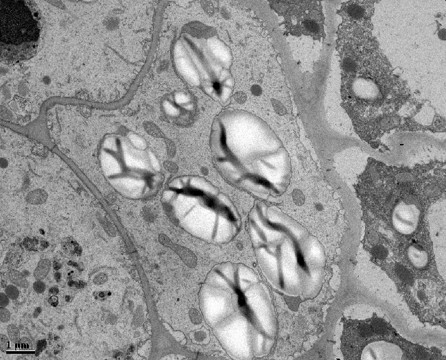 microscopic image of a plant cell with 7 large starch granules, taken with a transmission electron microscope