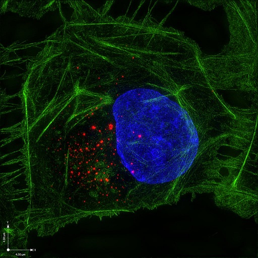 Super-resolution image of Zika virus replication complex (red) in mammalian cell 24 hours post-infection 