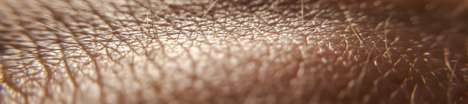 Closeup of skin