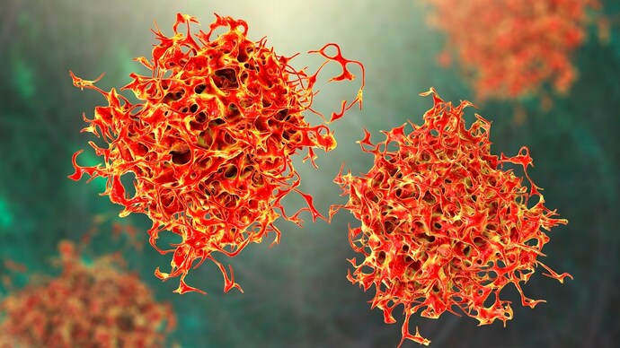 cancer cells