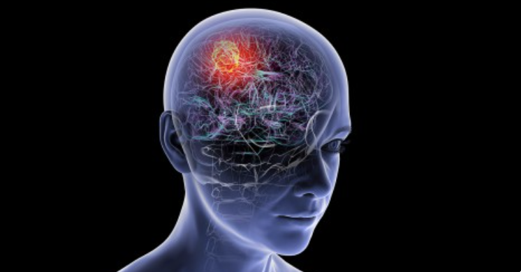 Brain