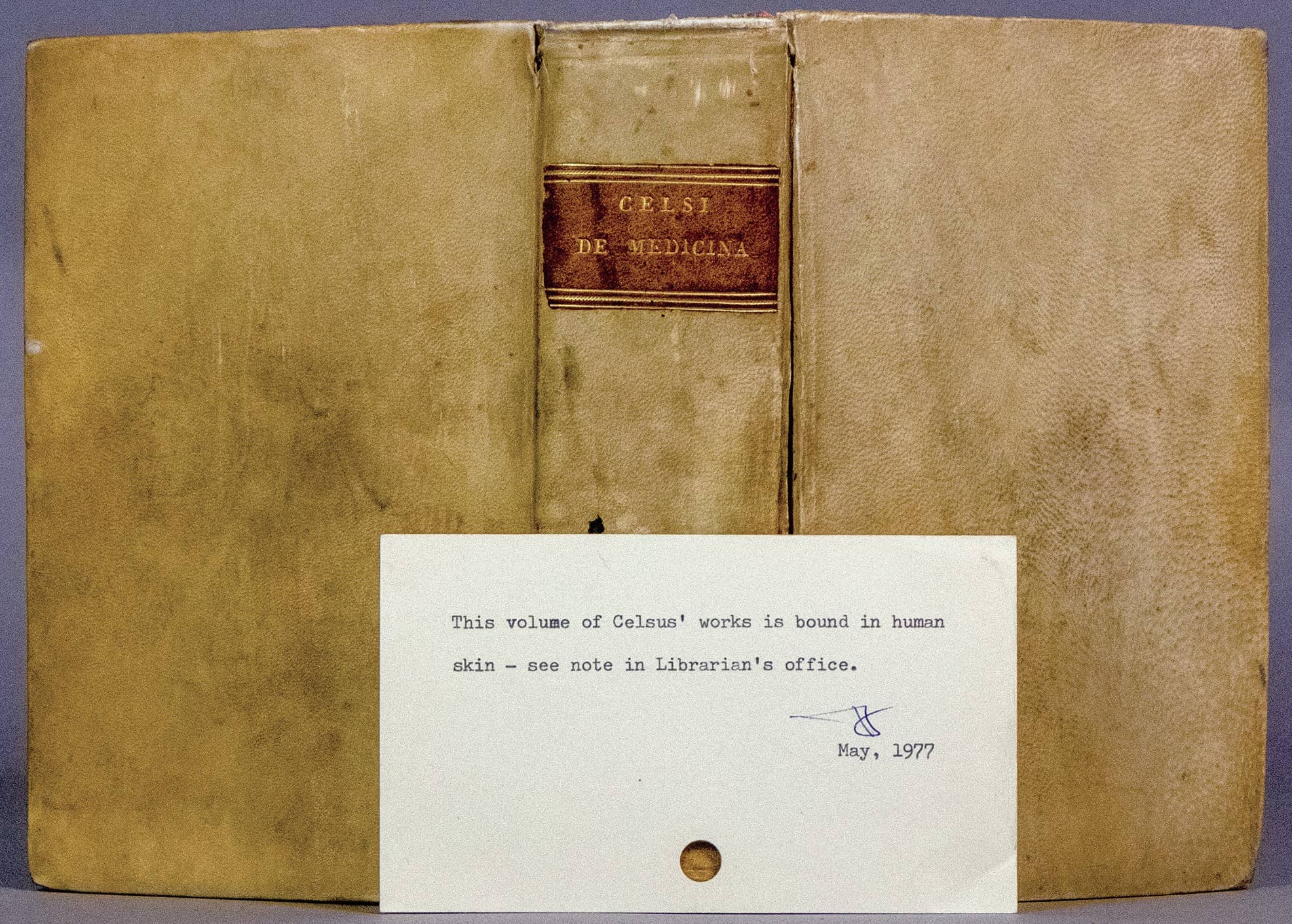 Cover of the the Celsi de medicina libri octo, a second-century medical treatise falsely rumoured to be bound in human flesh