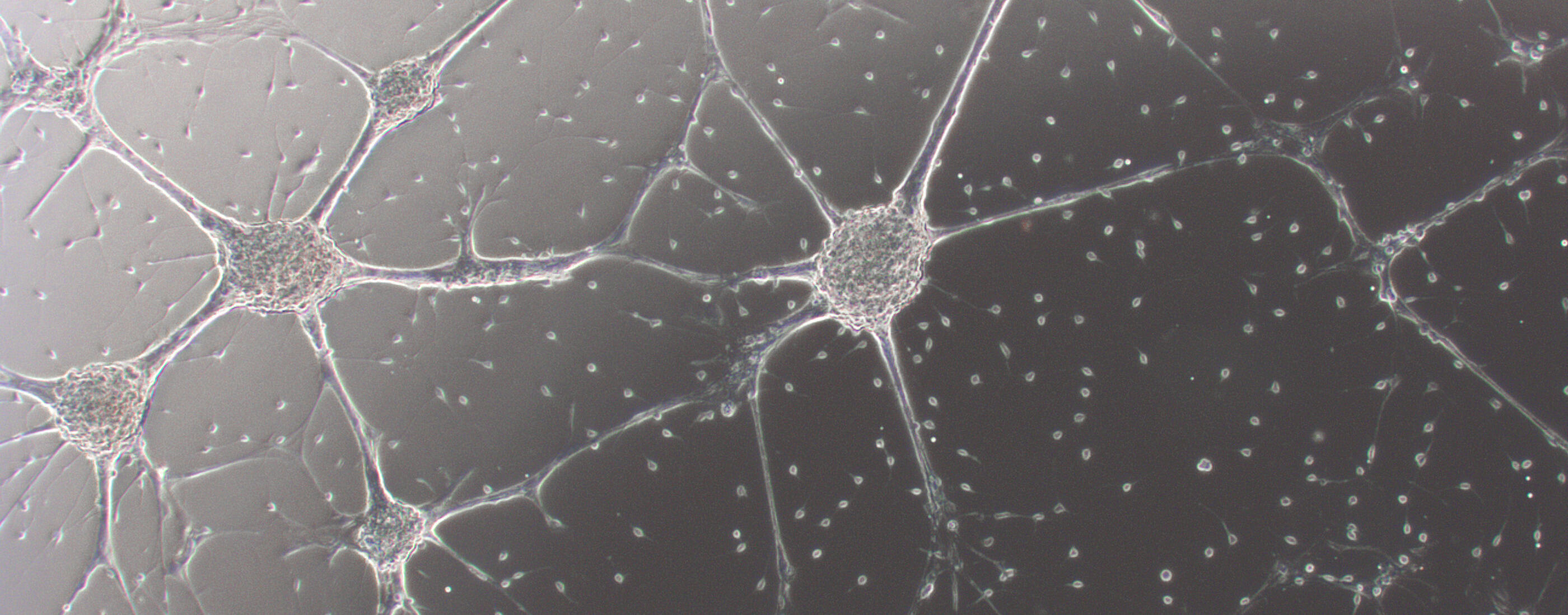 Image from Voronova Lab, University of Alberta