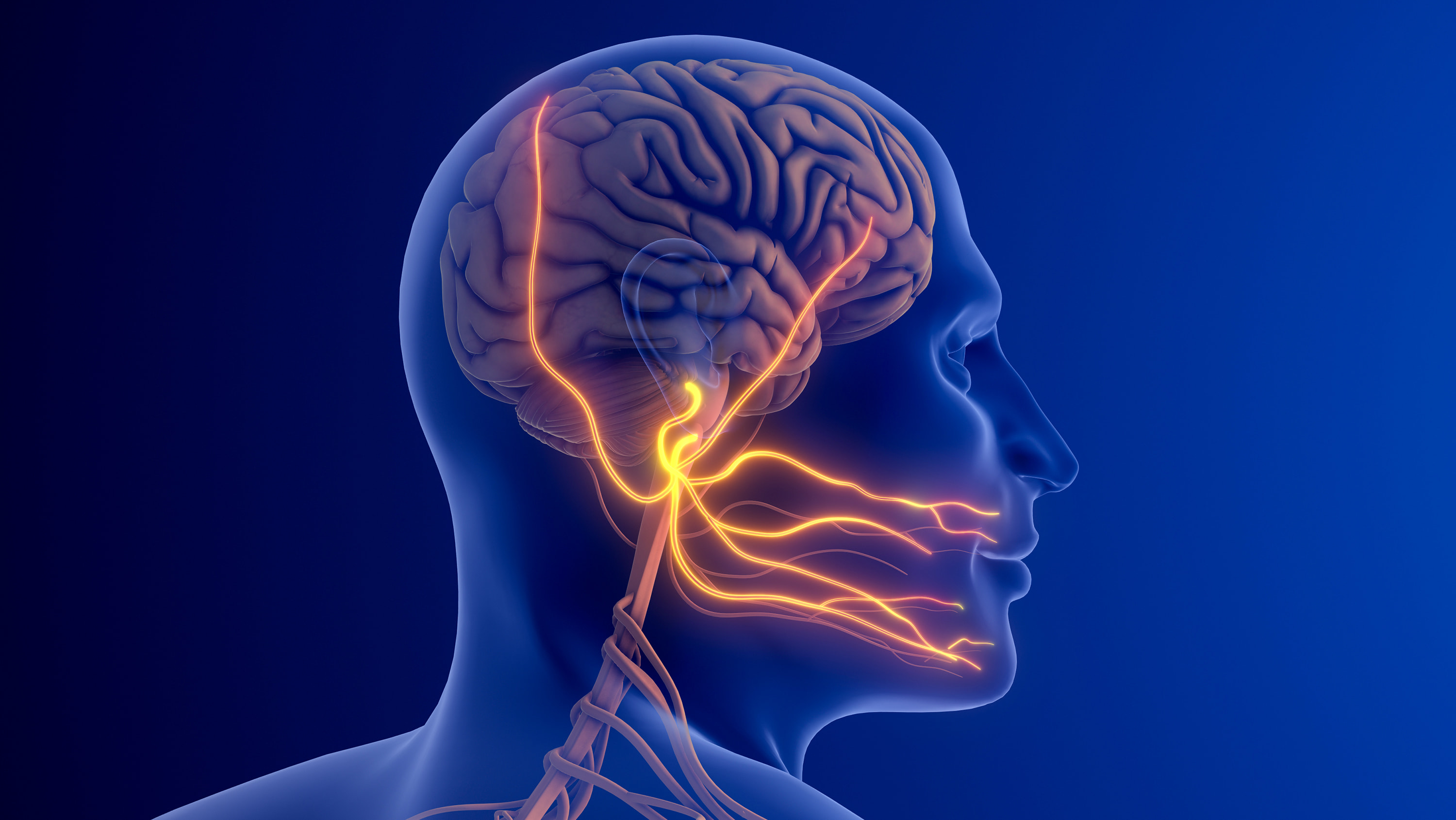 Trigeminal Neuralgia