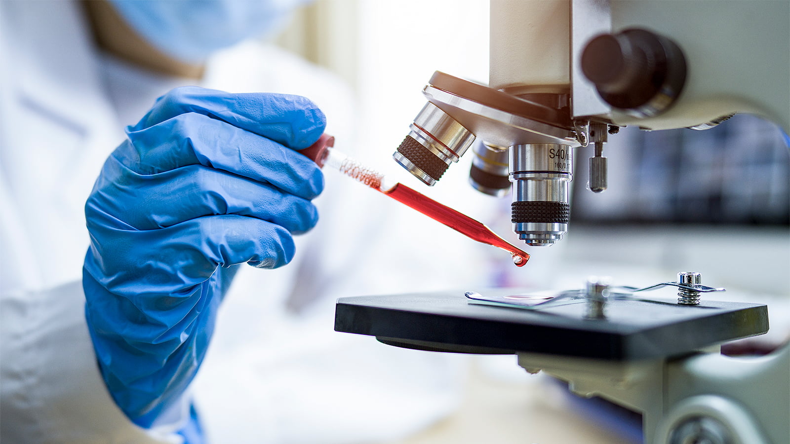 A gloved hand places a droplet of blood under a microscope. (Photo: Getty Images)