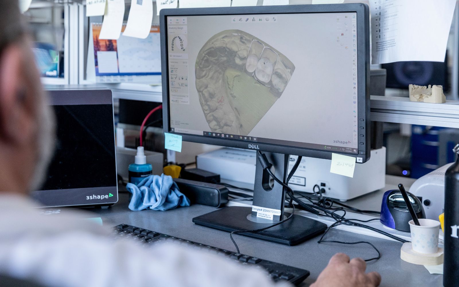 In-house prosthodontics laboratory