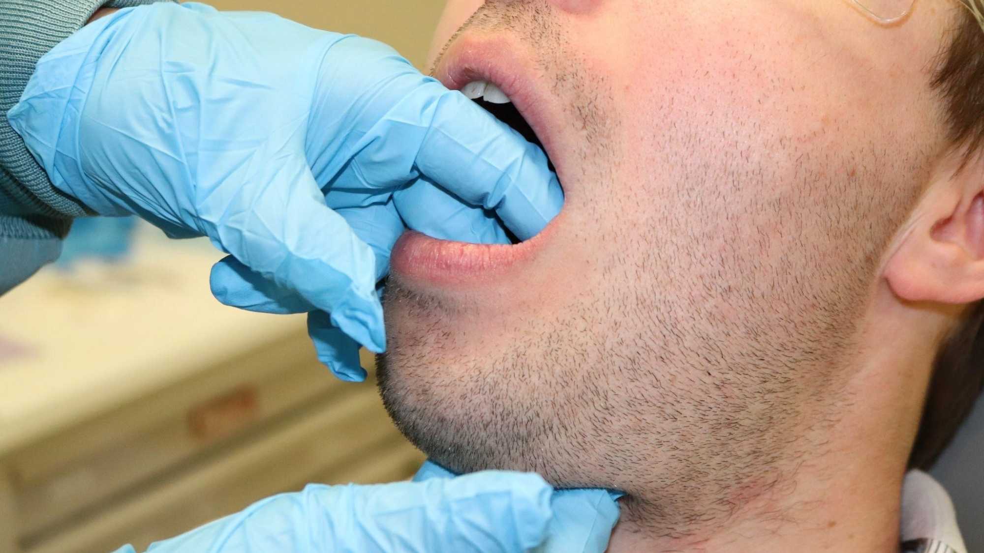 Bimanual palpation of the floor of mouth