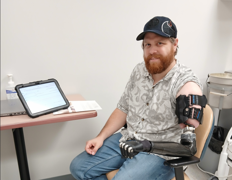 man with bionic limb prosthete arm