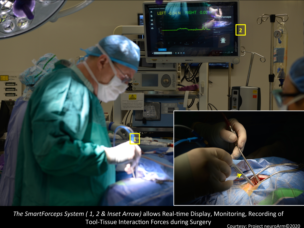 2021-08-23_neuroarm-team-in-surgery.jpg