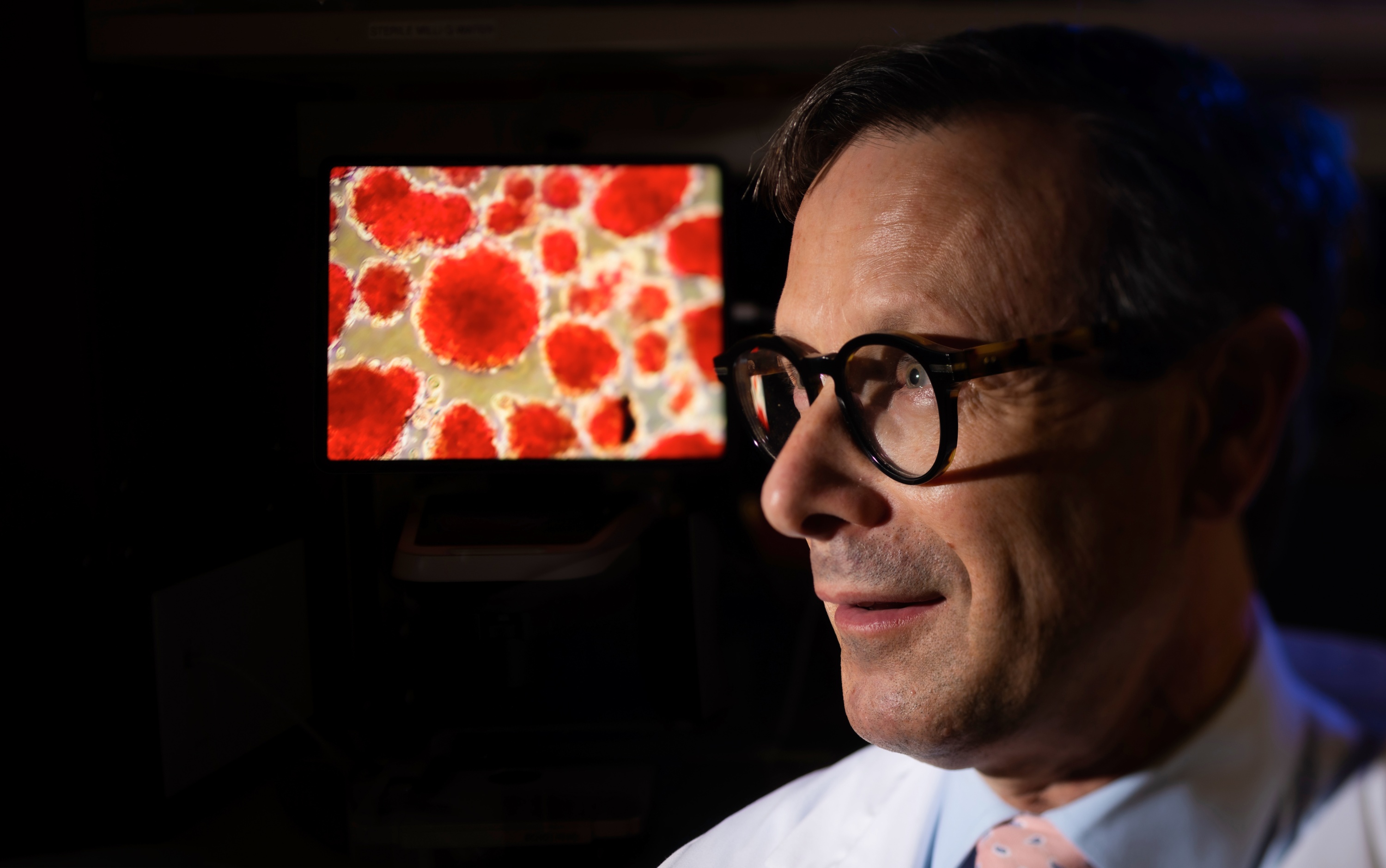 James Shapiro is pictured with a computer monitor displaying islet cells. (Photo: John Ulan)