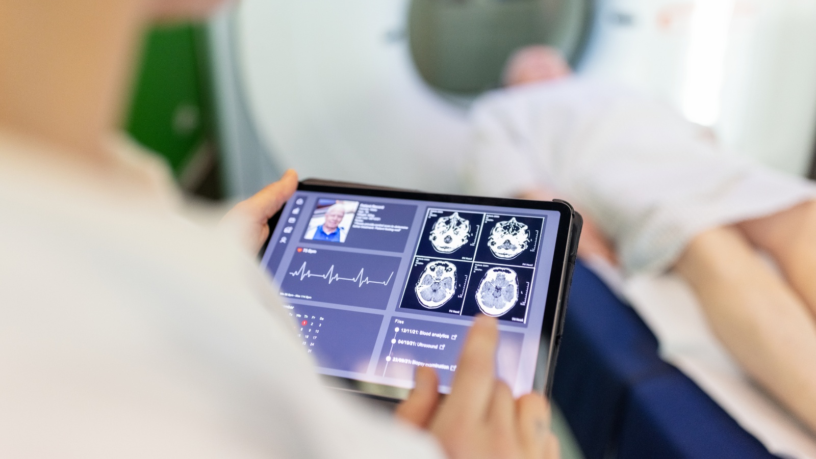 U of A researchers will use artificial intelligence to read brain images of suspected stroke patients, creating a blood flow map and highlighting blocked arteries to allow quicker diagnosis and treatment. (Photo: Getty Images)