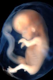 Image of a fetus