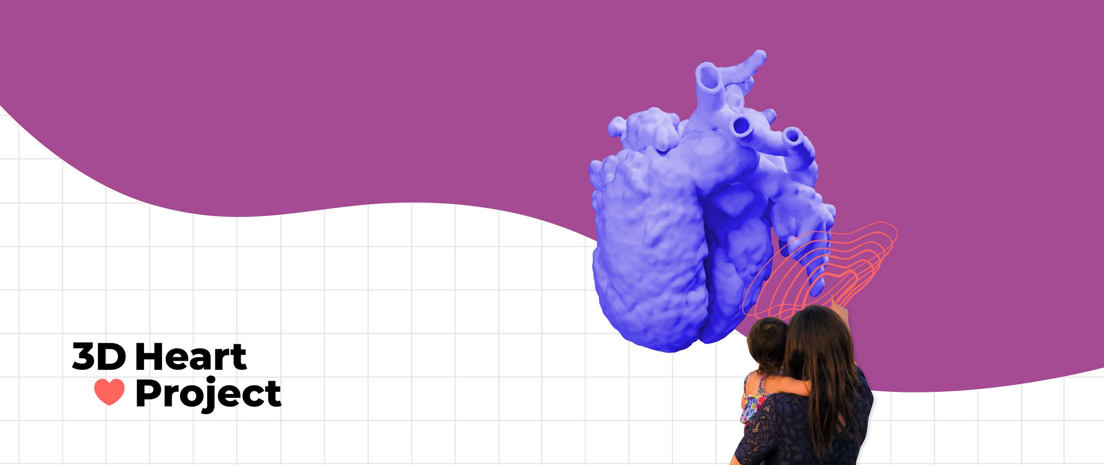 3D Visualization of Heart Disease banner