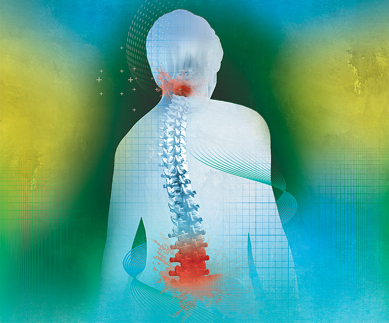 Illustration of a woman's back with a spine illustration overlay