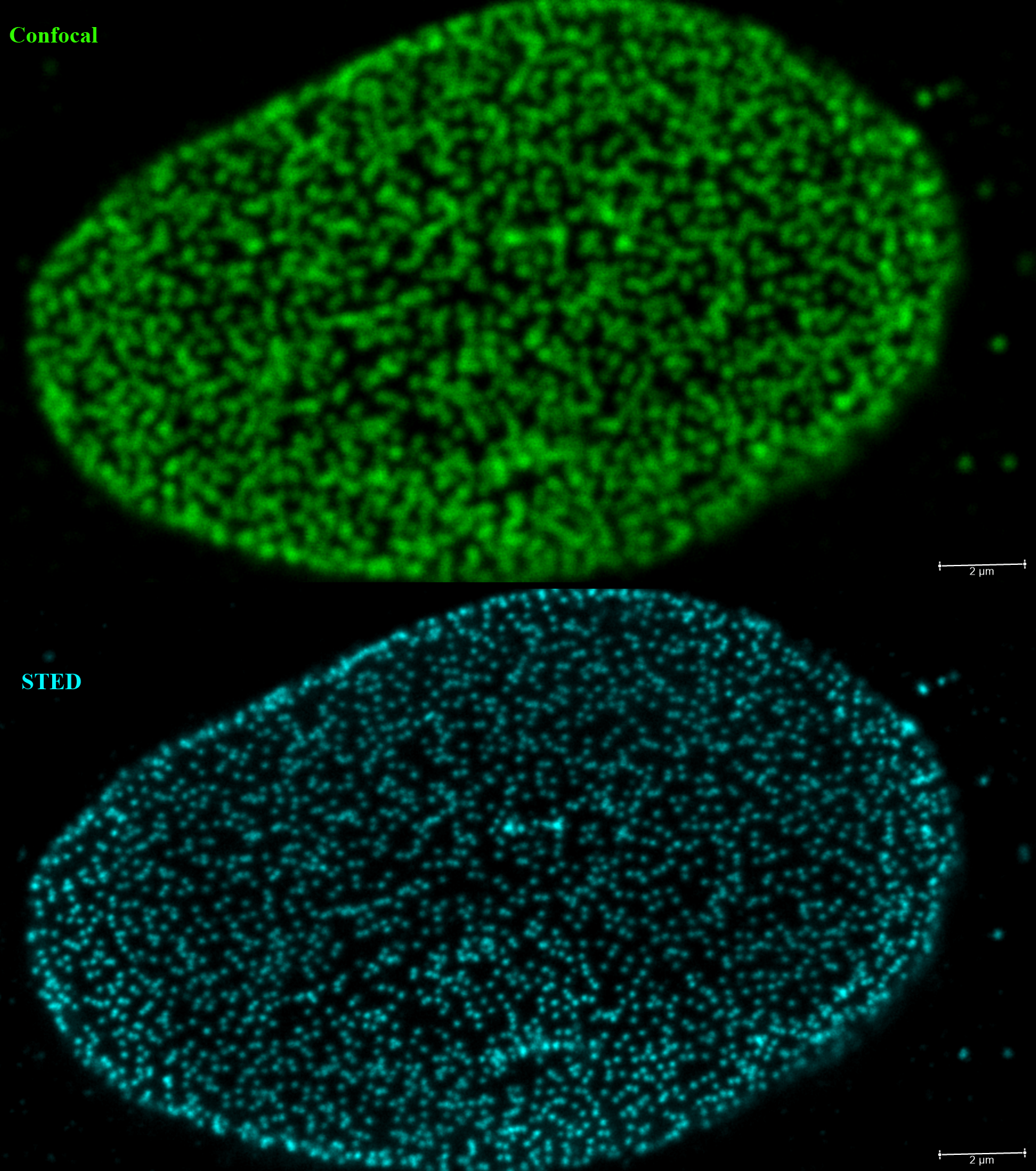 COS cells, confocal vs STED