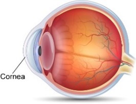 cornea-cataract.jpg