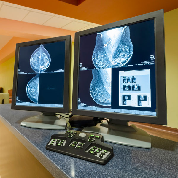 mammogram-health-centre-teaser.jpg