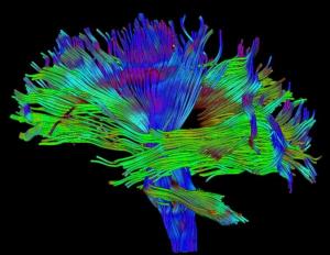 Tractography