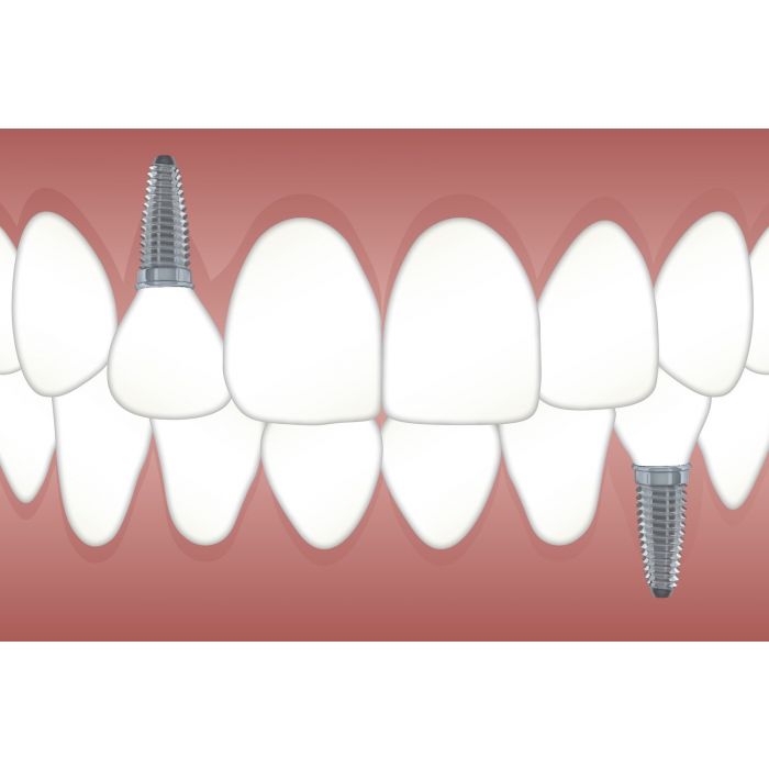 teeth-3597679_1920_1_.jpg