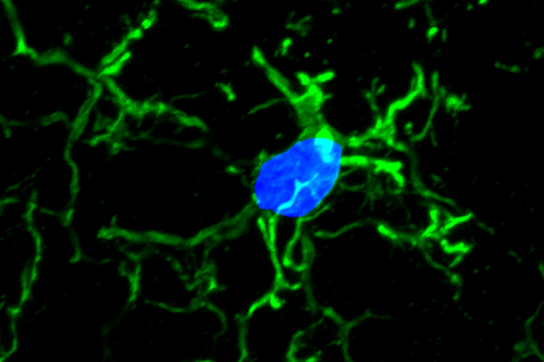 Immune cells in the brain called microglia play a role in the formation of neurodegenerative plaques. The image shows a microglial cell in normal/healthy conditions (in a mouse model).